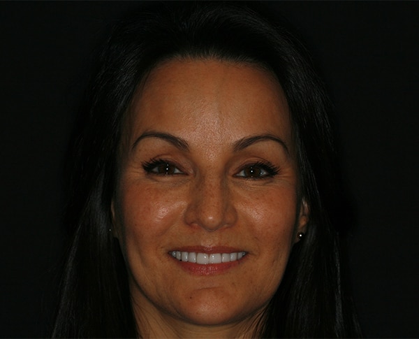 Konig Center for Cosmetic & Comprehensive Dentistry smile photos